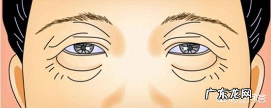 50多岁用,上眼皮下垂得厉害皱纹也比较多,请问什么眼霜可改善?