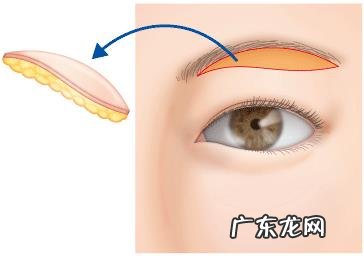 50多岁用,上眼皮下垂得厉害皱纹也比较多,请问什么眼霜可改善?