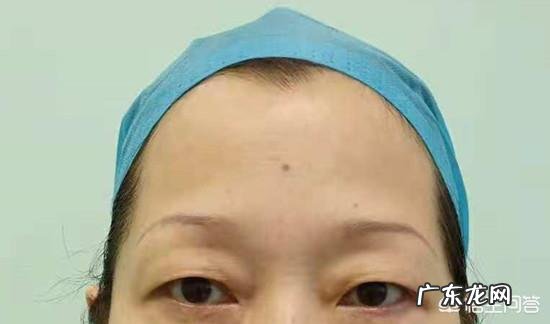 50多岁用,上眼皮下垂得厉害皱纹也比较多,请问什么眼霜可改善?