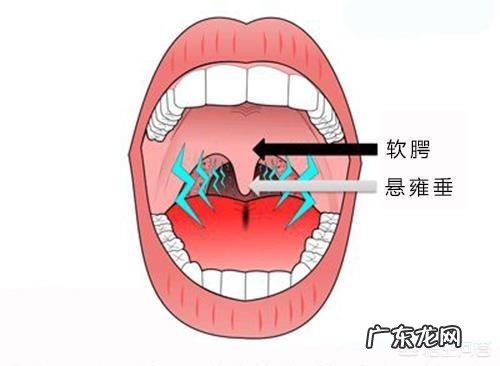 人为什么会打呼噜,怎样才能不打呼噜?