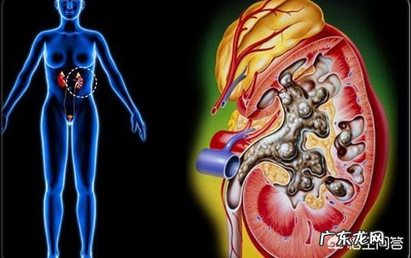 肾结石哪些蔬菜水果可以吃,哪些不可以吃?