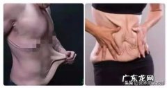 减肥过快导致肚子、胳膊等部位皮肉松弛，像这种情况怎么变得紧致起来？