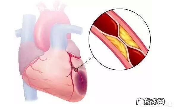血栓有哪些前兆?