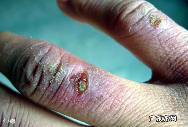 宝宝皮肤粗能不能用护肤品,适合什么护肤品?