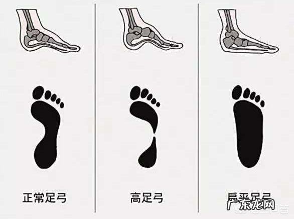 该如何选择跑步鞋?