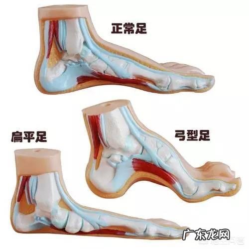 该如何选择跑步鞋？