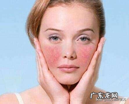 过敏体质是什么原因导致的呢?