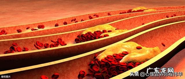 总胆固醇偏高是什么造成的？