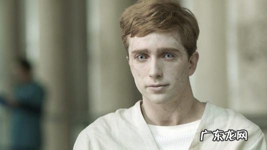 歌舞伎综合症真的漂亮吗 快乐木偶综合症是真的吗