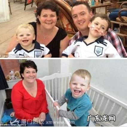 歌舞伎综合症真的漂亮吗 快乐木偶综合症是真的吗