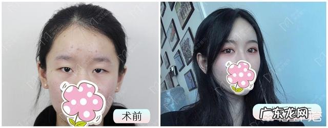 大家觉得双眼皮好看还是单眼皮好看?