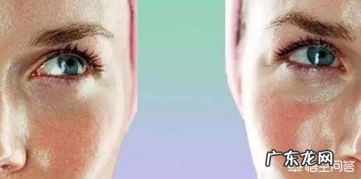 如何收缩毛孔?
