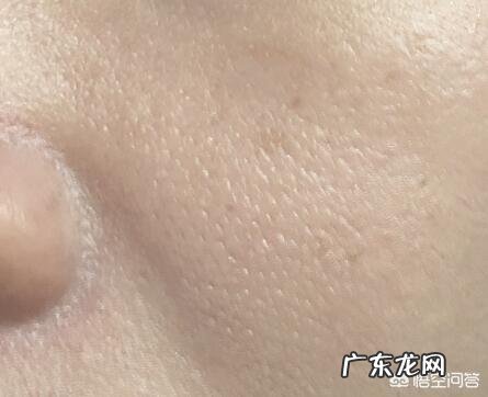 毛孔粗大,沙子撒脸上都能稳稳的卡住,该怎么收缩毛孔?