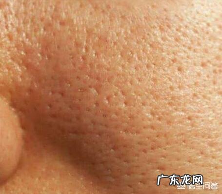 毛孔粗大,沙子撒脸上都能稳稳的卡住,该怎么收缩毛孔?