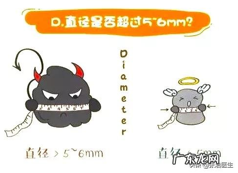 身上哪些部位的黑痣需要警惕，可能是癌症的信号？