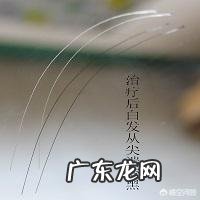 拔罐真的能祛湿吗?