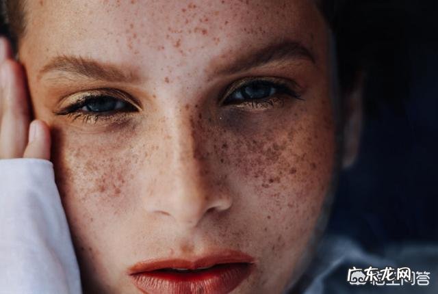 黄褐斑在哪个季节最明显?该怎么办?