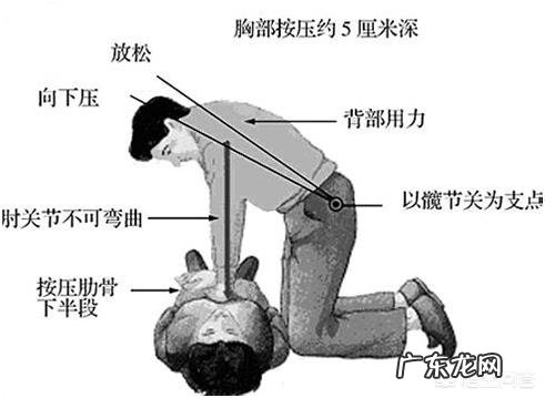 心脏病患者能用心肺复苏方式急救吗?
