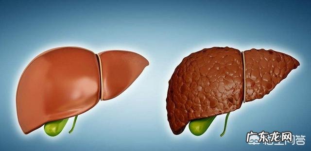 肝不好的人,会有哪些症状?