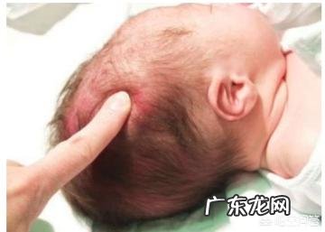 先天性佝偻病的宝宝有什么症状?