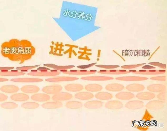 女性皮肤粗糙爱出油怎么办,有哪些护肤经验分享吗?