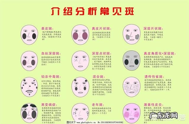 什么是雀斑?怎么去除?