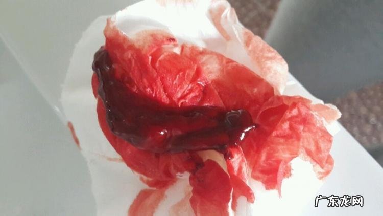 子宫内膜脱落是怎么回事正常吗 子宫内膜脱落真正图片