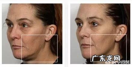 有那么多家用美容仪，到底哪一款真的有效果、值得入手？