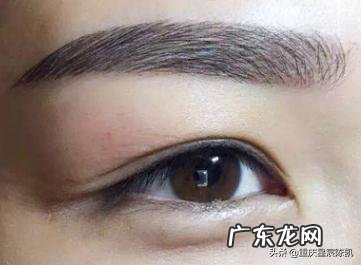 玻尿酸丰眼窝效果自然吗?