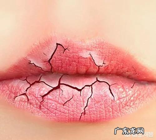 嘴唇干裂脱皮是什么原因引起的？