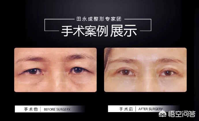 上眼皮松弛,该怎么化妆?