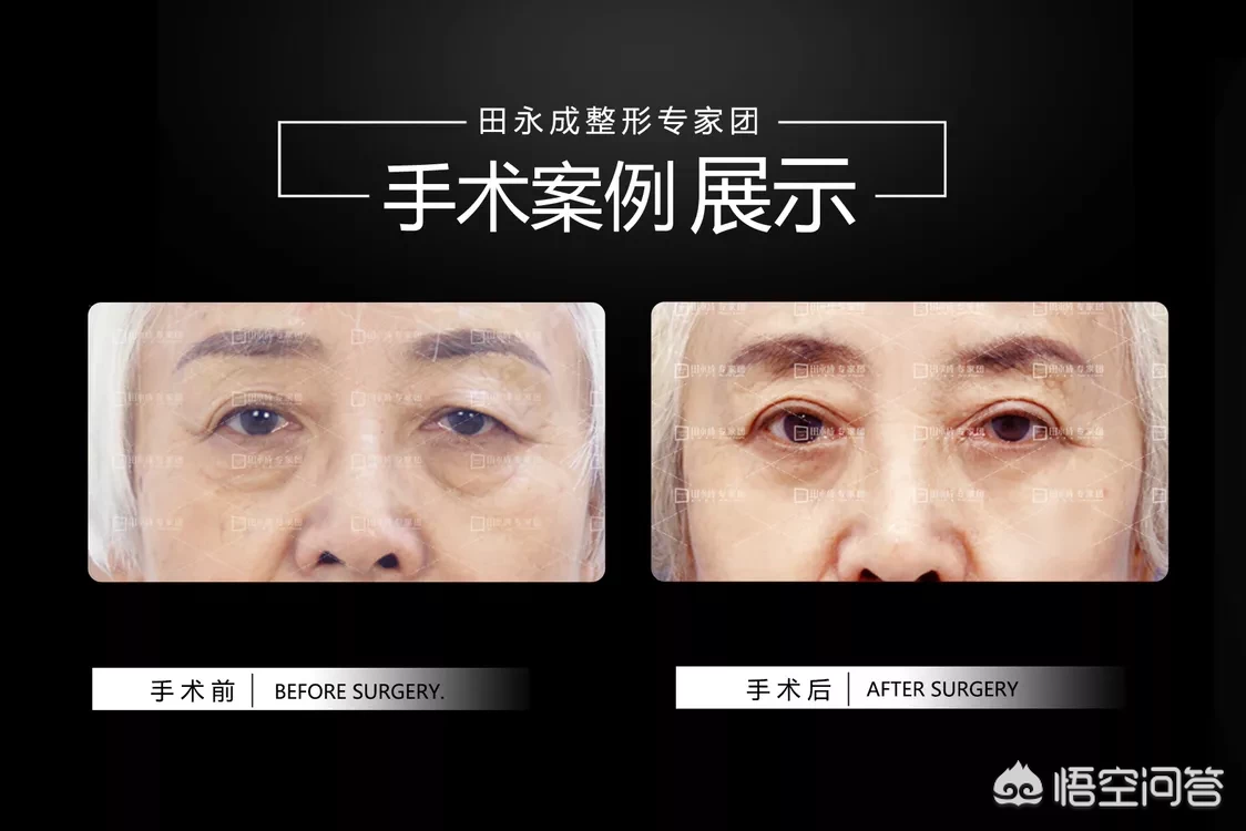 上眼皮松弛,该怎么化妆?