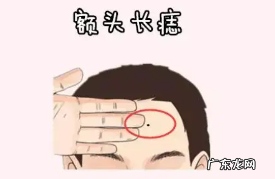 痣是否可以去除 痣可以去除吗