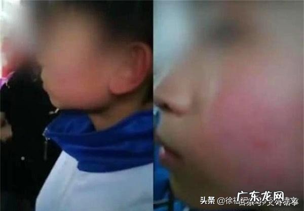 儿子喊校长绰号被扇耳光送医检查,6天后父亲从其子病房坠亡,你怎么评价?