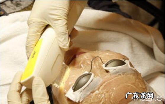 光子嫩肤会反弹吗?