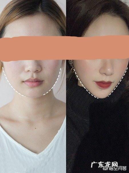 瘦脸针有什么副作用吗?