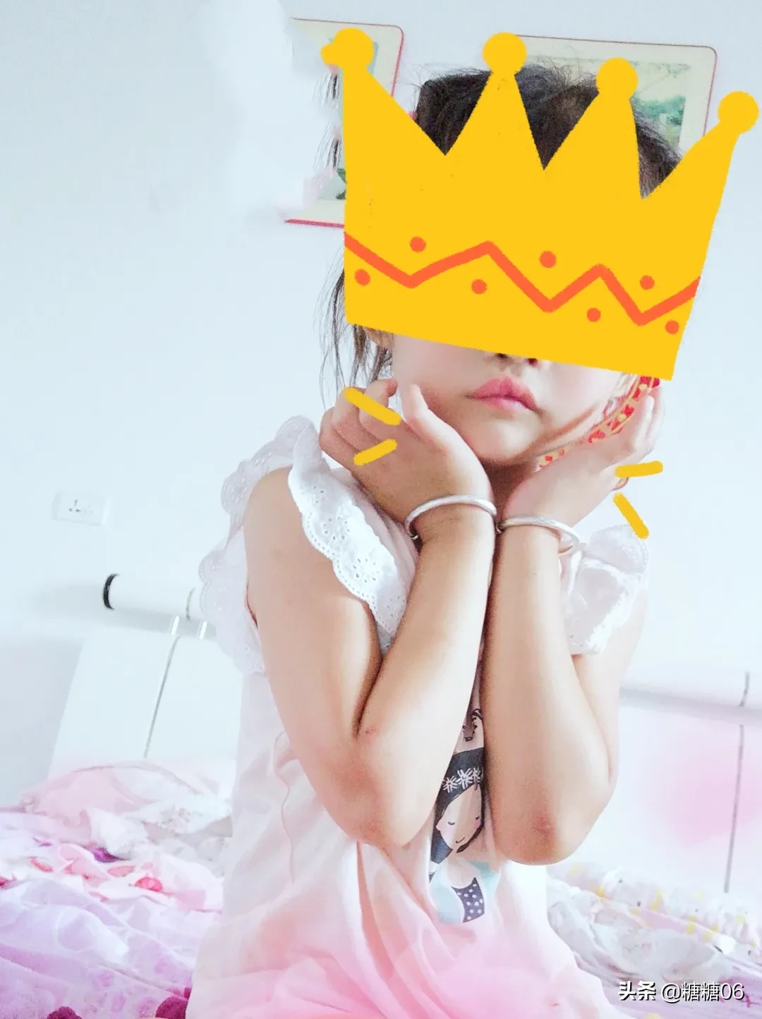 兔唇宝宝是孕期什么阶段及什么原因造成的?