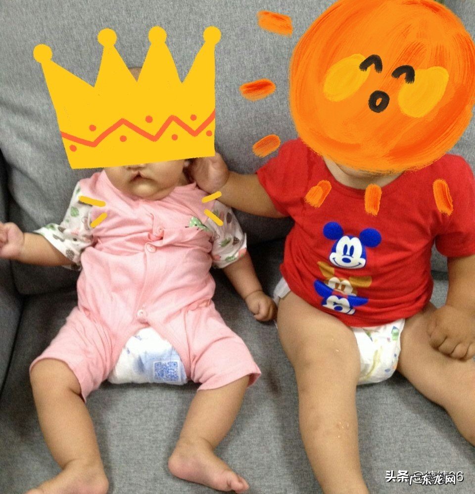 兔唇宝宝是孕期什么阶段及什么原因造成的?