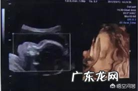 三维彩超好多钱?