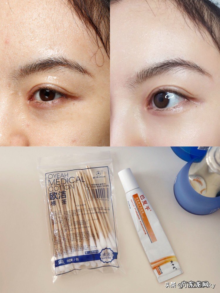 冬季怎么保护皮肤?