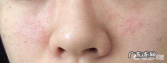 冬季怎么保护皮肤?