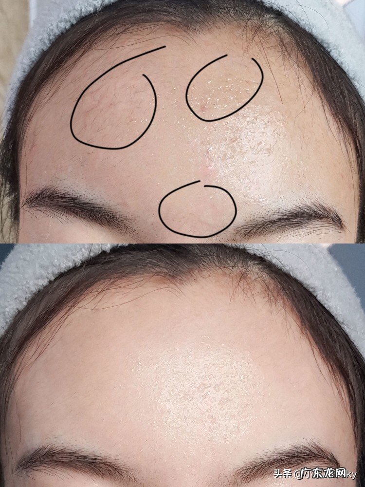 冬季怎么保护皮肤?