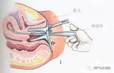 超导可视和微管可视哪个好 超导可视