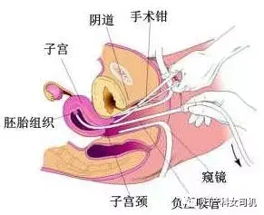 超导可视和微管可视哪个好 超导可视