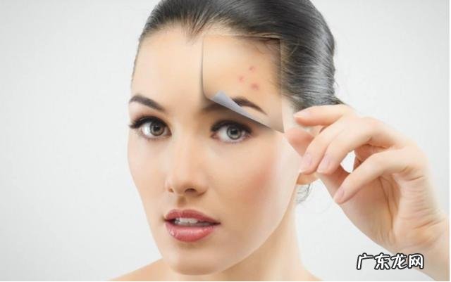 祛黑痘印产品推荐,遮挡痘印最好用的产品