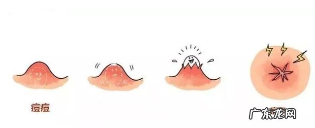 祛黑痘印产品推荐,遮挡痘印最好用的产品