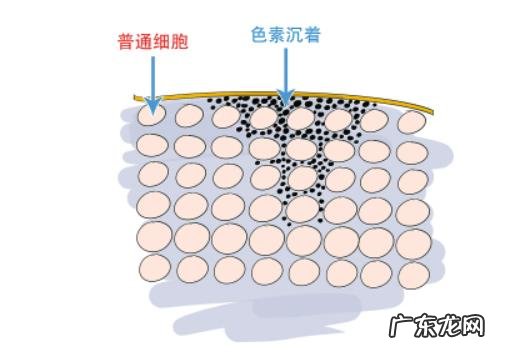 祛黑痘印产品推荐,遮挡痘印最好用的产品