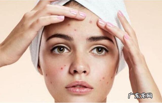 祛黑痘印产品推荐,遮挡痘印最好用的产品