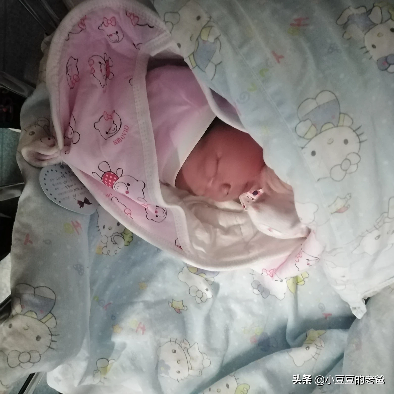 你生孩子的时候疼吗?