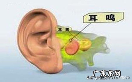 为什么脑鸣去医院检查不出来呢?